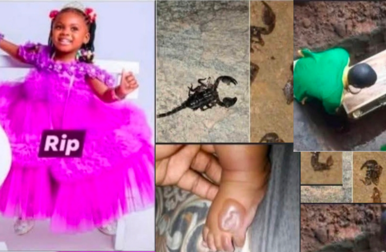 HEARTBREAKING: 2-Year-Old Girl Reportedly D¡es After Scorpion Sting