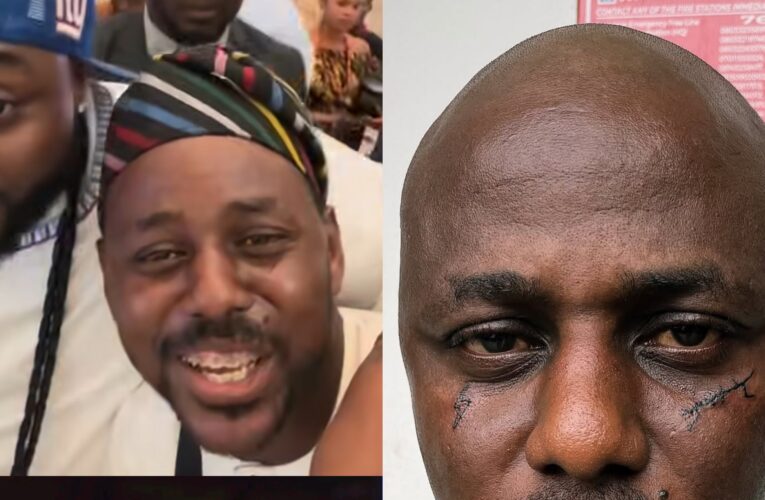 😳👀 Lekki Street Boy Unveils Bold New Face Tattoo, Sparks Mixed Reactions