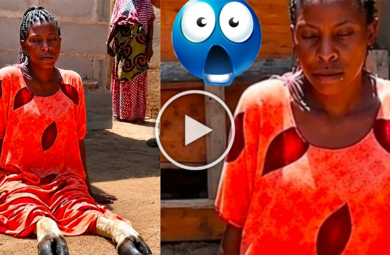 Cow legs: 21-YEAR-OLD LADY ALLEGEDLY WAKES UP TO FIND HER LEGS “TRANSFORMED” AFTER AFFAIR WITH MARRIED MAN 😳🐄